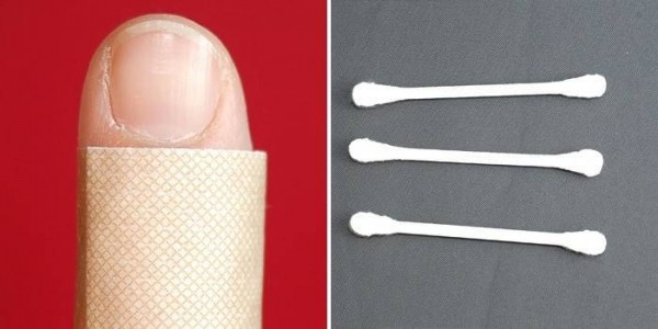 Креолин от грибка ногтей: лечение и отзывы