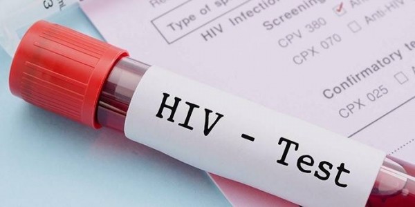 Признаки ВИЧ у женщин